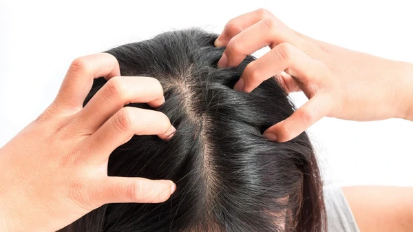 Улучшает состояние кожи головы: эксперт рассказала всю правду о популя...