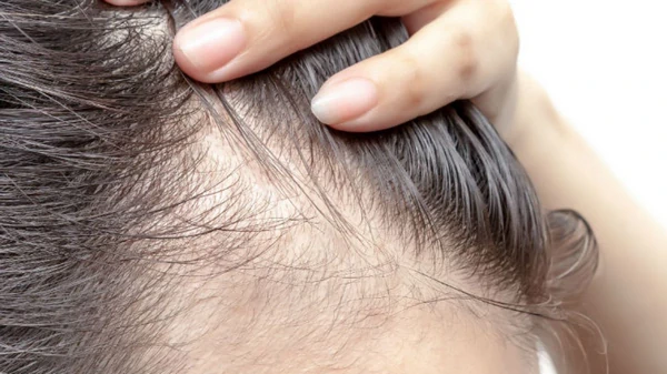 От стресса и болезни до расы: какие внешние факторы влияют на рост вол...