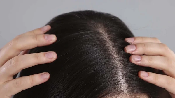 Как избавиться от перхоти?