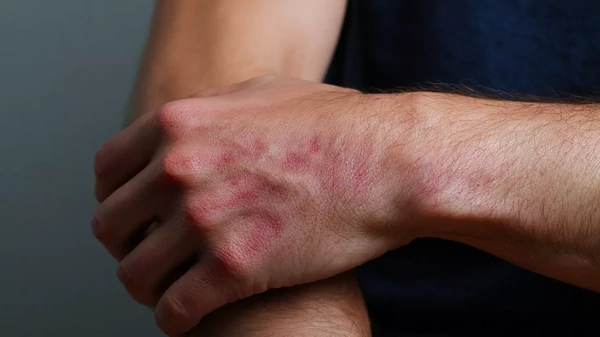 7 сигналов вашей кожи, предупреждающие о серьезных заболеваниях