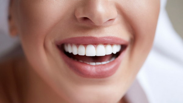 Улыбка на миллион: как отбелить зубы в домашних условиях за 3 минуты